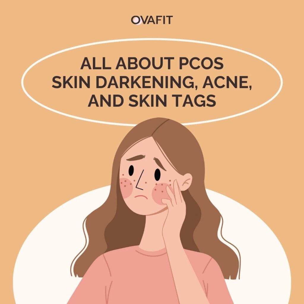 All About Pcos Skin Darkening Acne And Skin Tags Ovafit