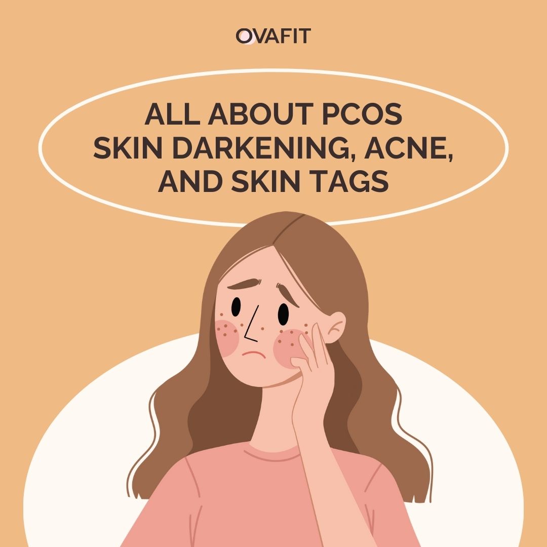 all about pcos,skin darkening, acne, and skin tags