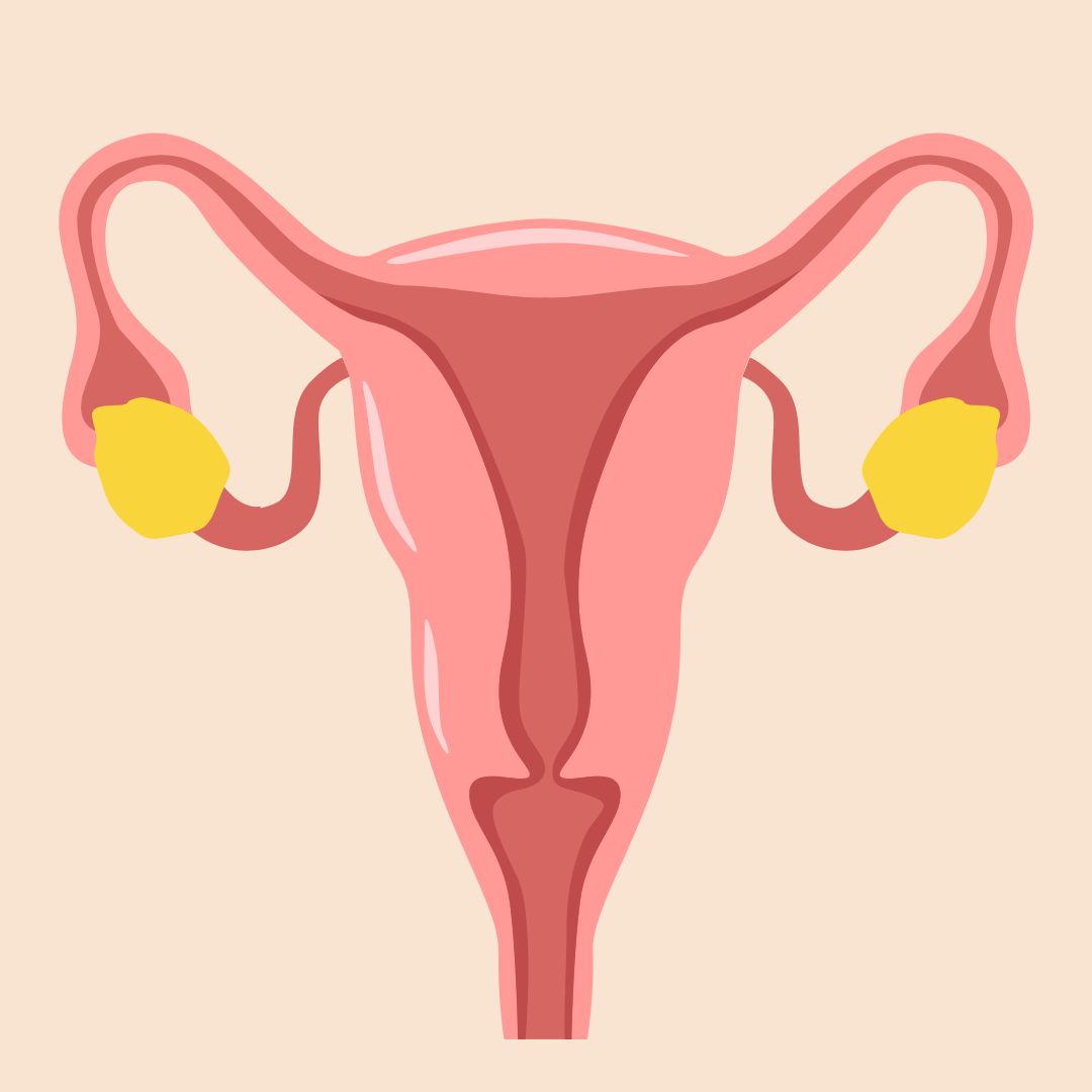 Does a Hysterectomy Cure PCOS?