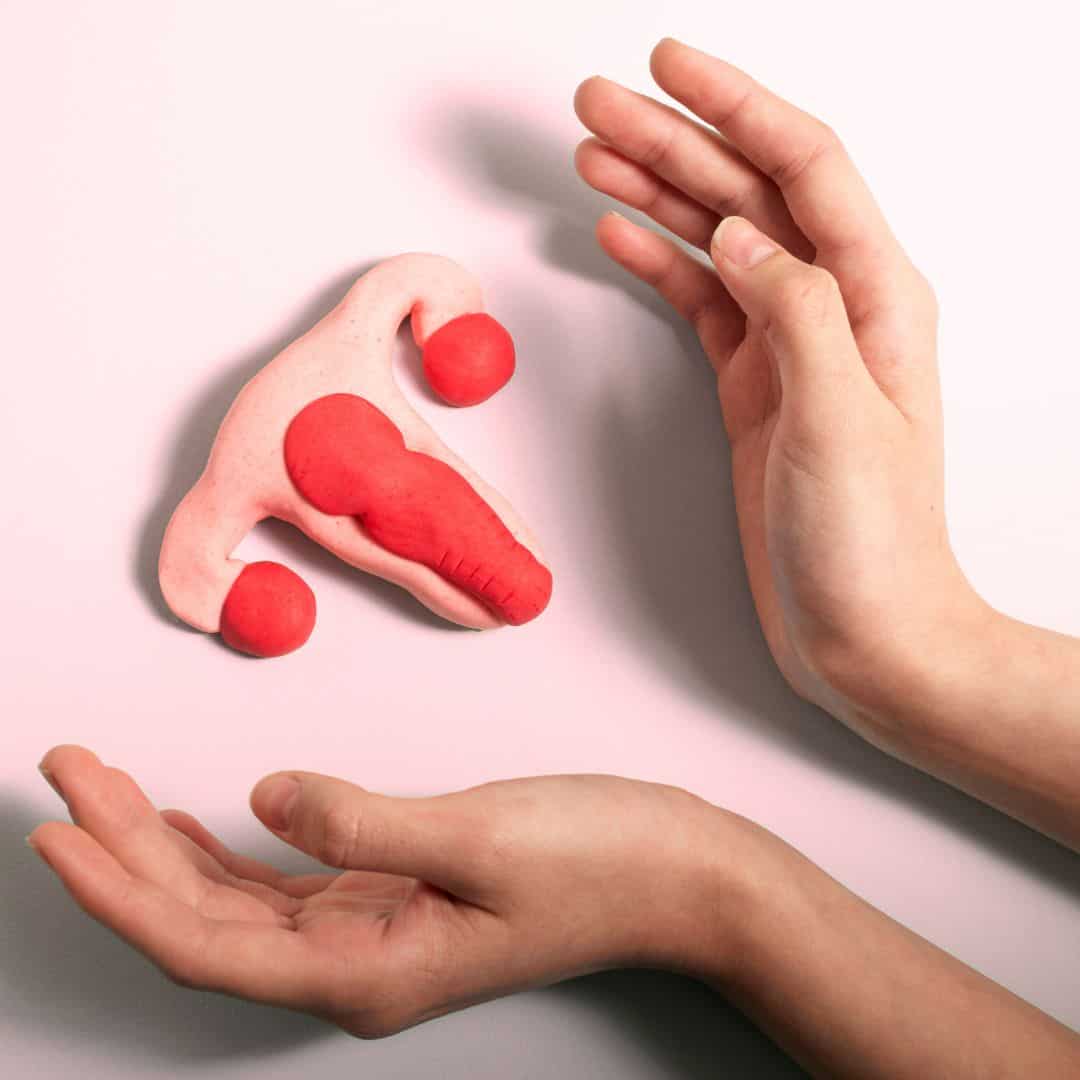 PCOS Types: How to Identify Which Type You Have