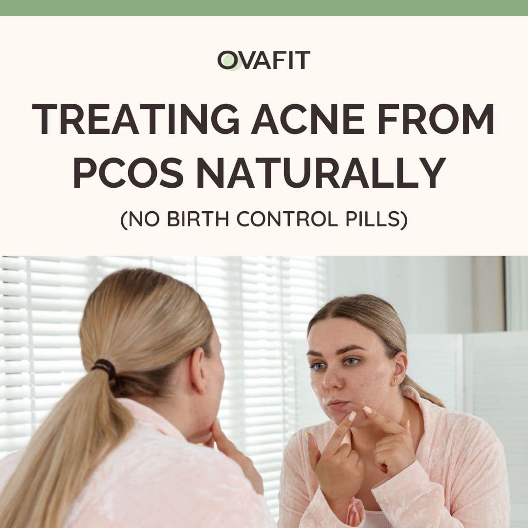Treating Acne from PCOS naturally Treating Acne from PCOS naturally