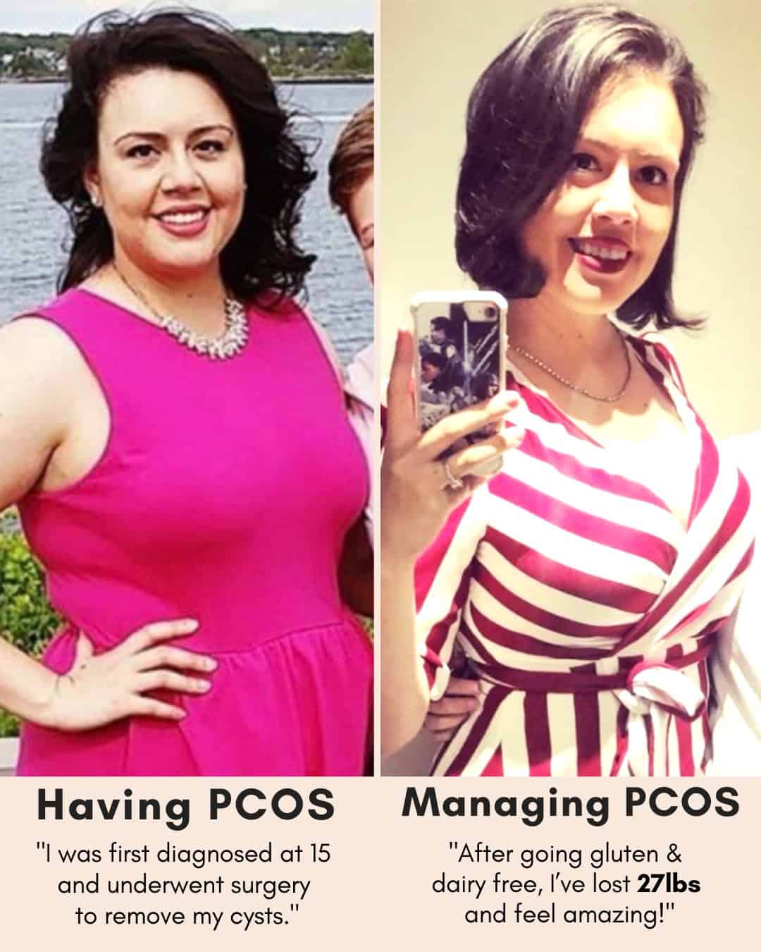 Cysterhood testimonial with before/after photos from Cysterhood member
