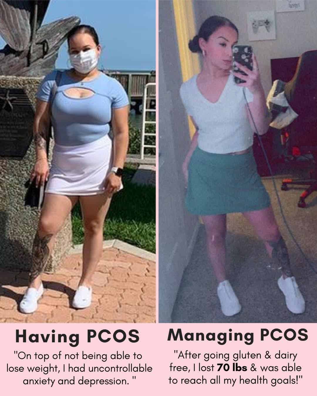 Cysterhood testimonial with before/after photos from Cysterhood member