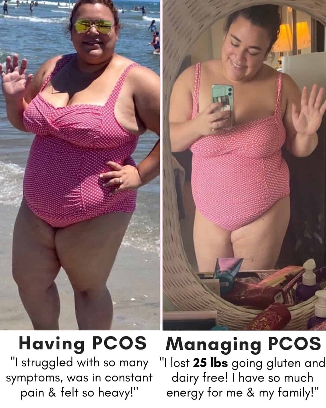 Cysterhood testimonial with before/after photos from Cysterhood member