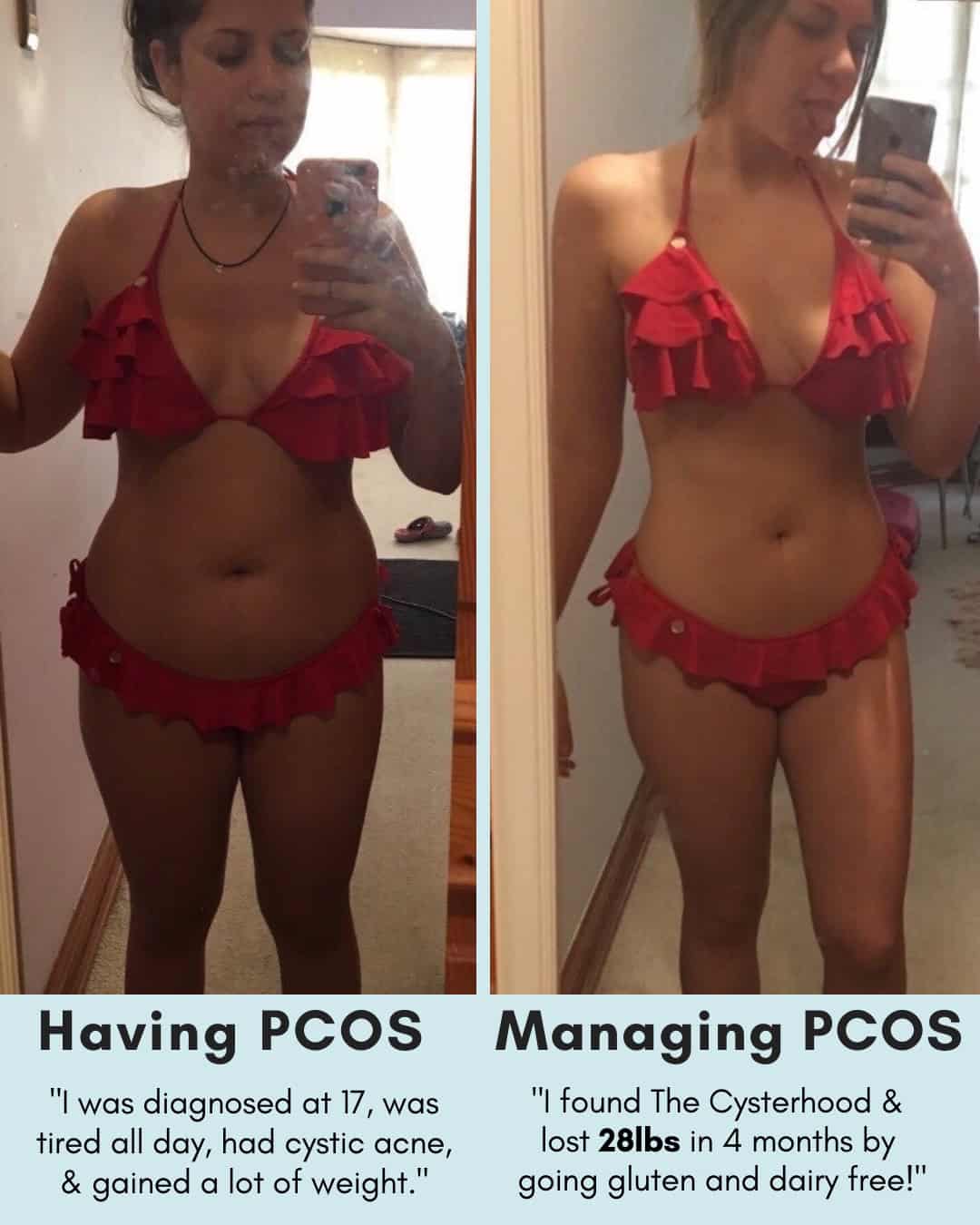 Cysterhood testimonial with before/after photos from Cysterhood member