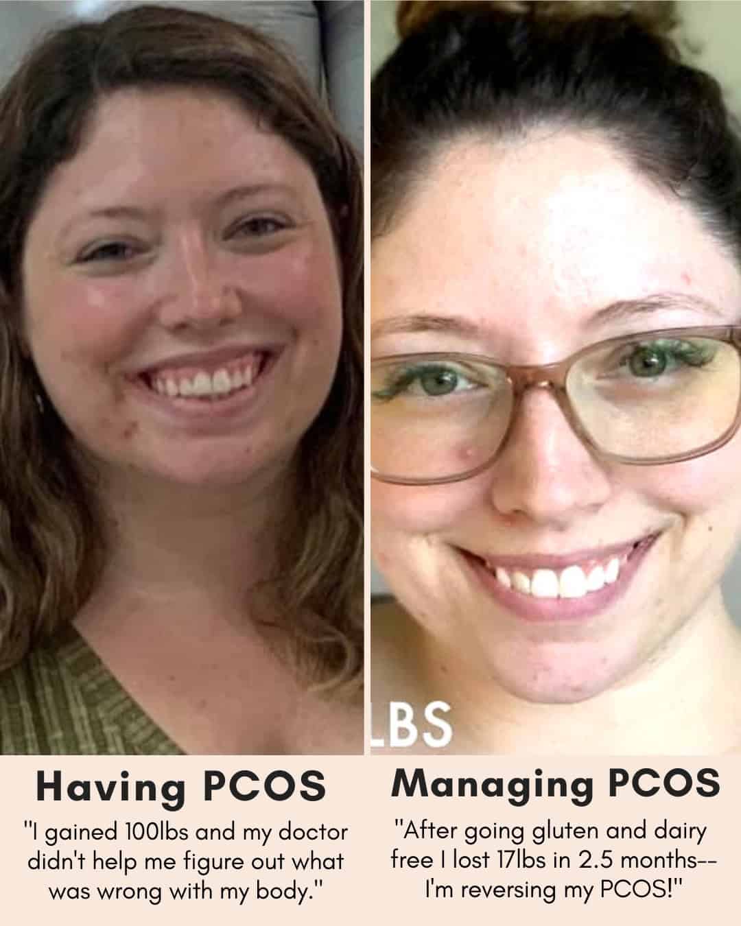 Cysterhood testimonial with before/after photos from Cysterhood member