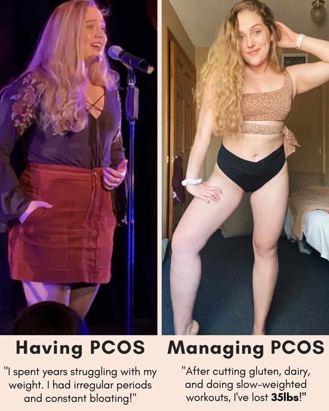 Cysterhood testimonial with before/after photos from Cysterhood member