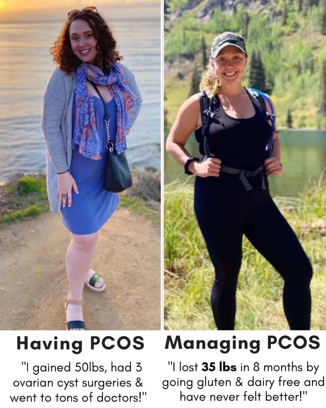 Cysterhood testimonial with before/after photos from Cysterhood member