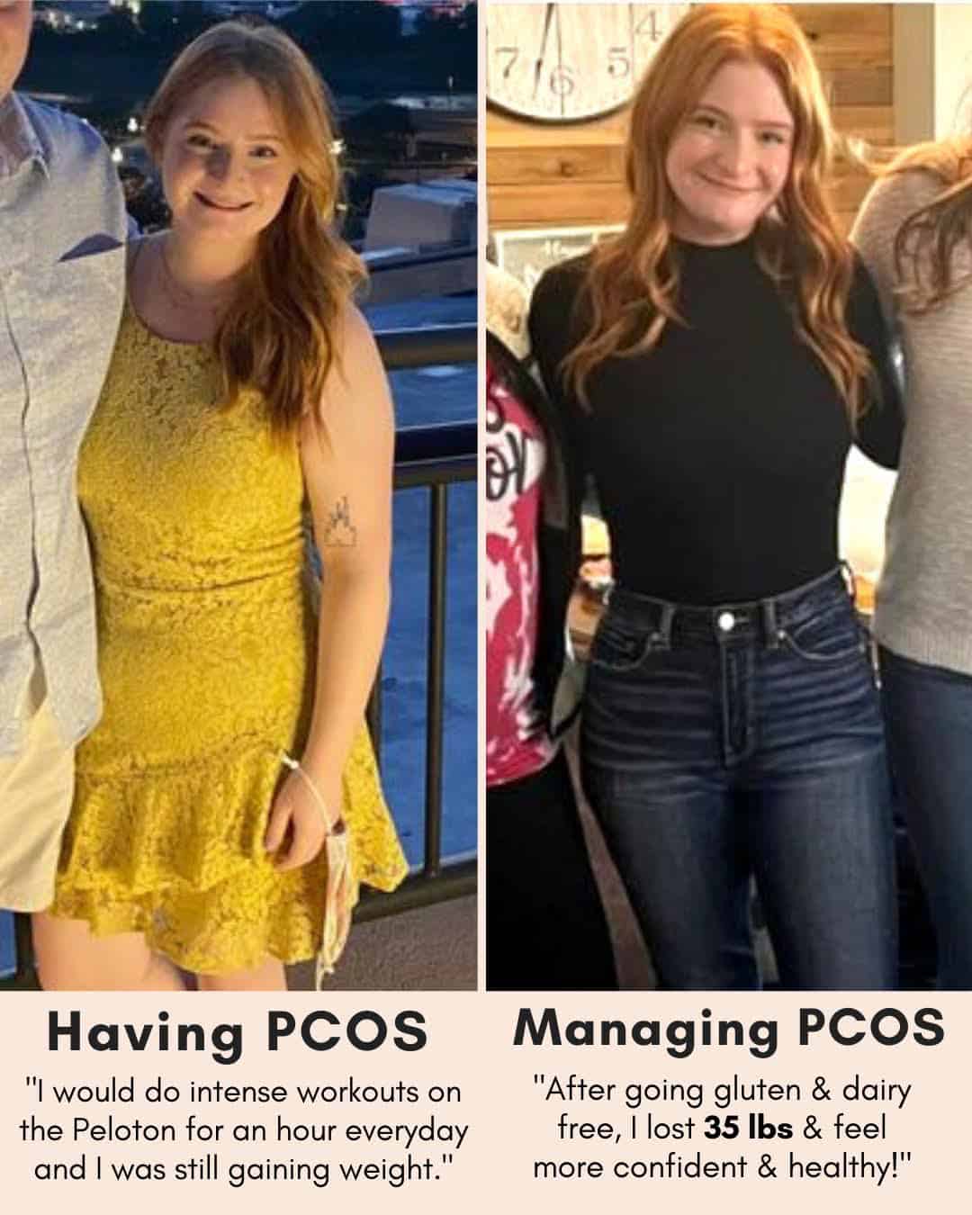 Cysterhood testimonial with before/after photos from Cysterhood member