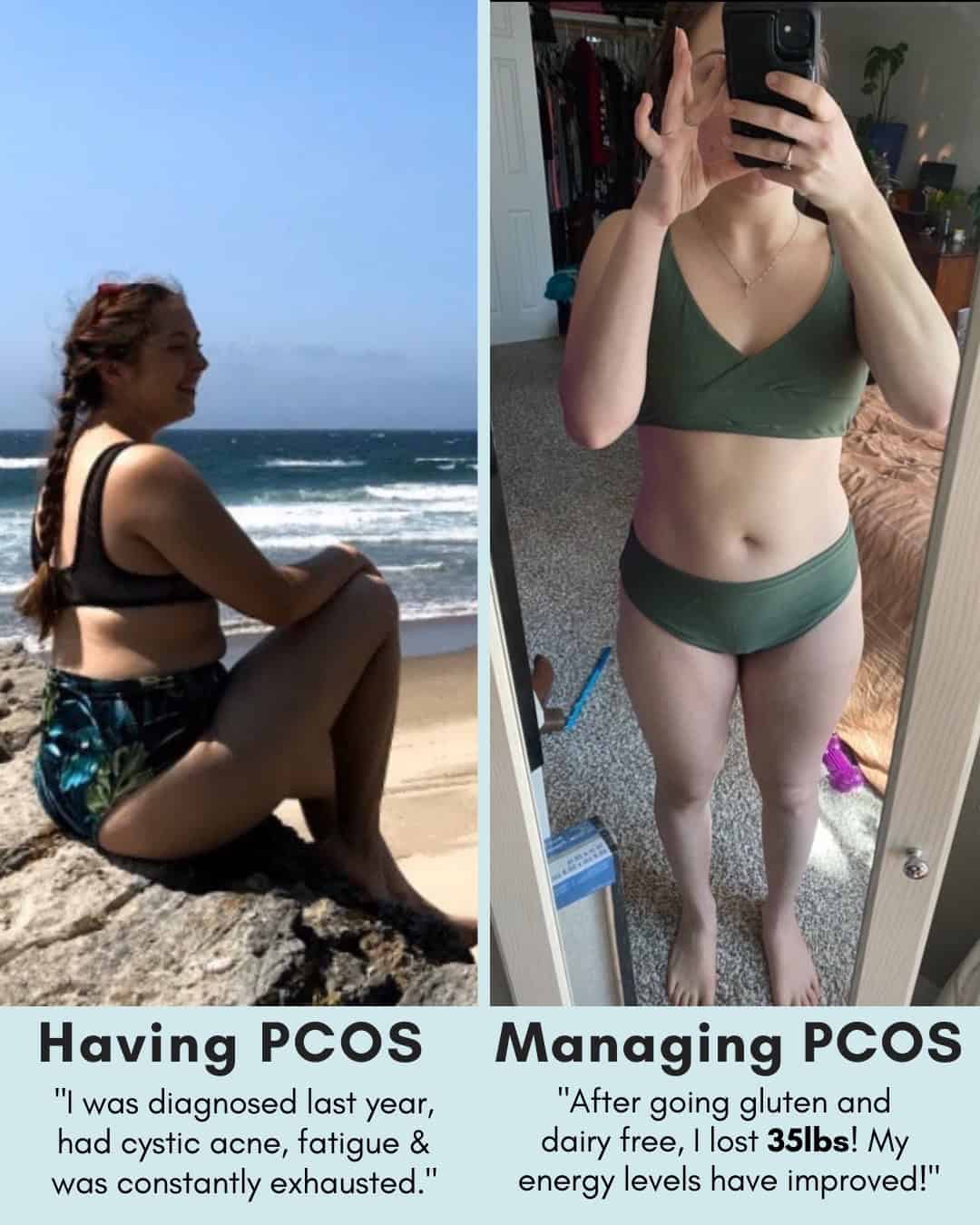 Cysterhood testimonial with before/after photos from Cysterhood member