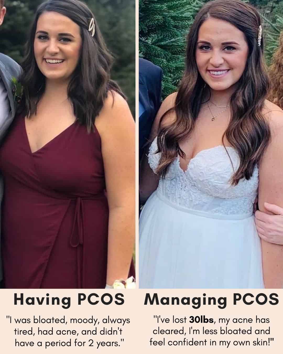 Cysterhood testimonial with before/after photos from Cysterhood member
