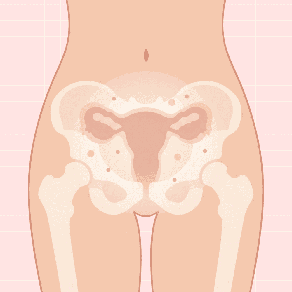 Can You Have PCOS and Endometriosis_ How to Tell the Difference