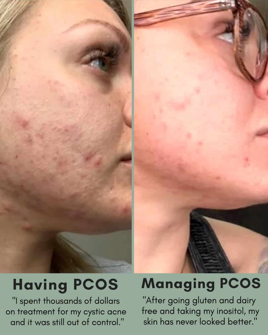 Cysterhood testimonial with before/after photos from Cysterhood member