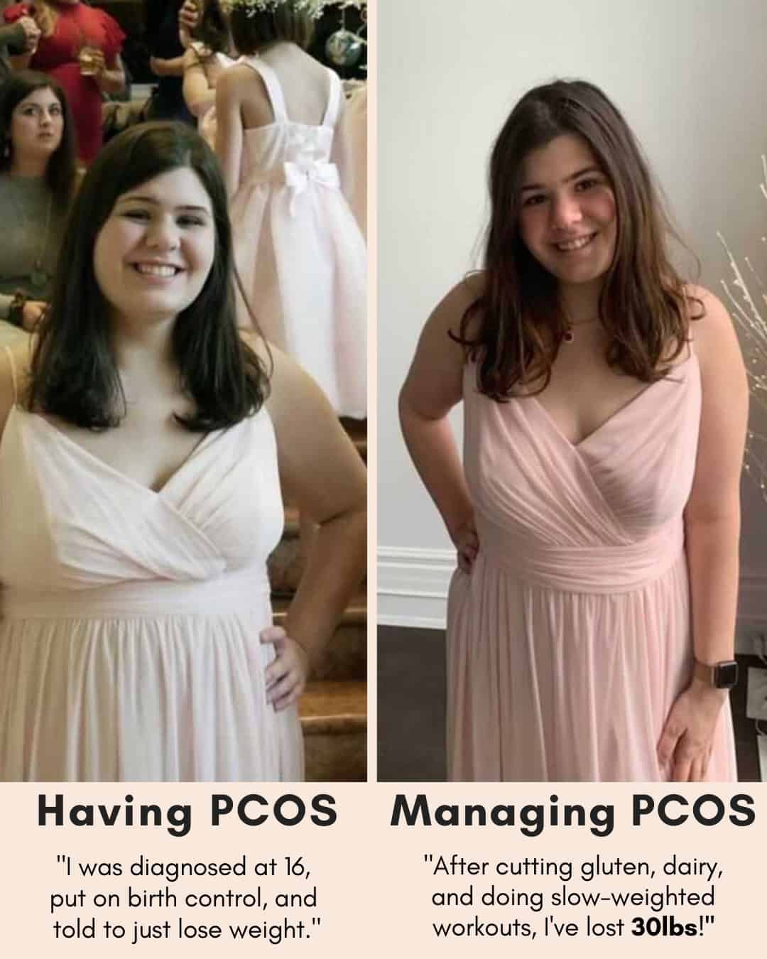 Cysterhood testimonial with before/after photos from Cysterhood member