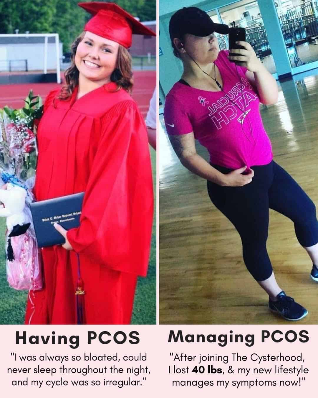 Cysterhood testimonial with before/after photos from Cysterhood member