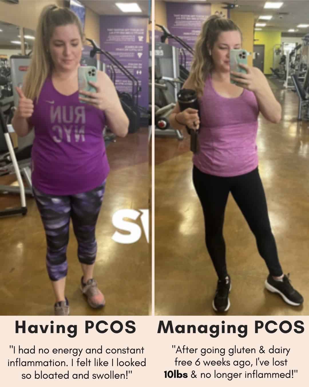 Cysterhood testimonial with before/after photos from Cysterhood member