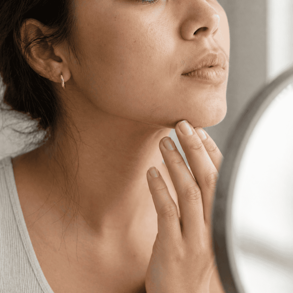 How to Stop Facial Hair Growth Due to PCOS Naturally